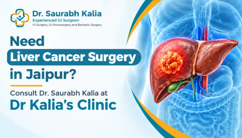 Need Liver Cancer Surgery in Jaipur? Dr. Saurabh Kalia - Medical And Health care in Jaipur for ₹600