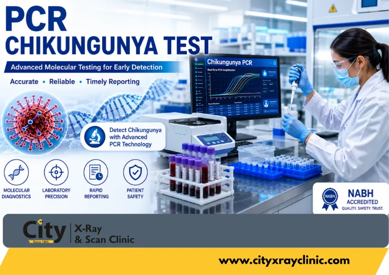 PCR Chikungunya Test – Book Now