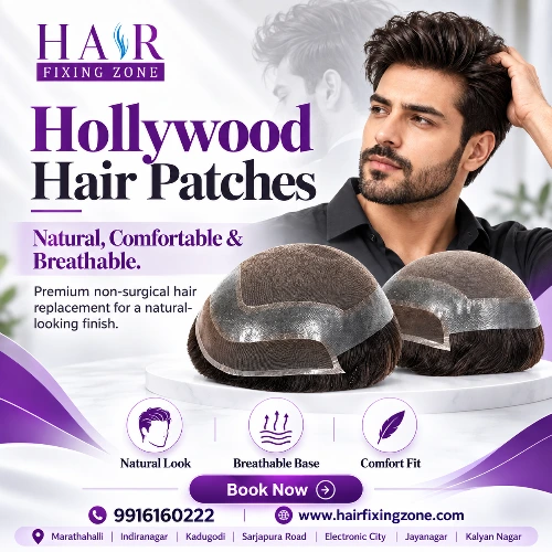 Hair Patches for Men Bangalore