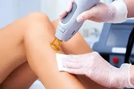 Laser Hair Removal Facial Hair Pleasanton